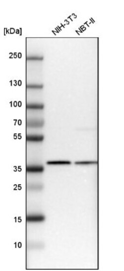 Ymer Antibody, Novus Biologicals 25 &mu;L | Buy Online | Novus Biologicals | Fisher Scientific